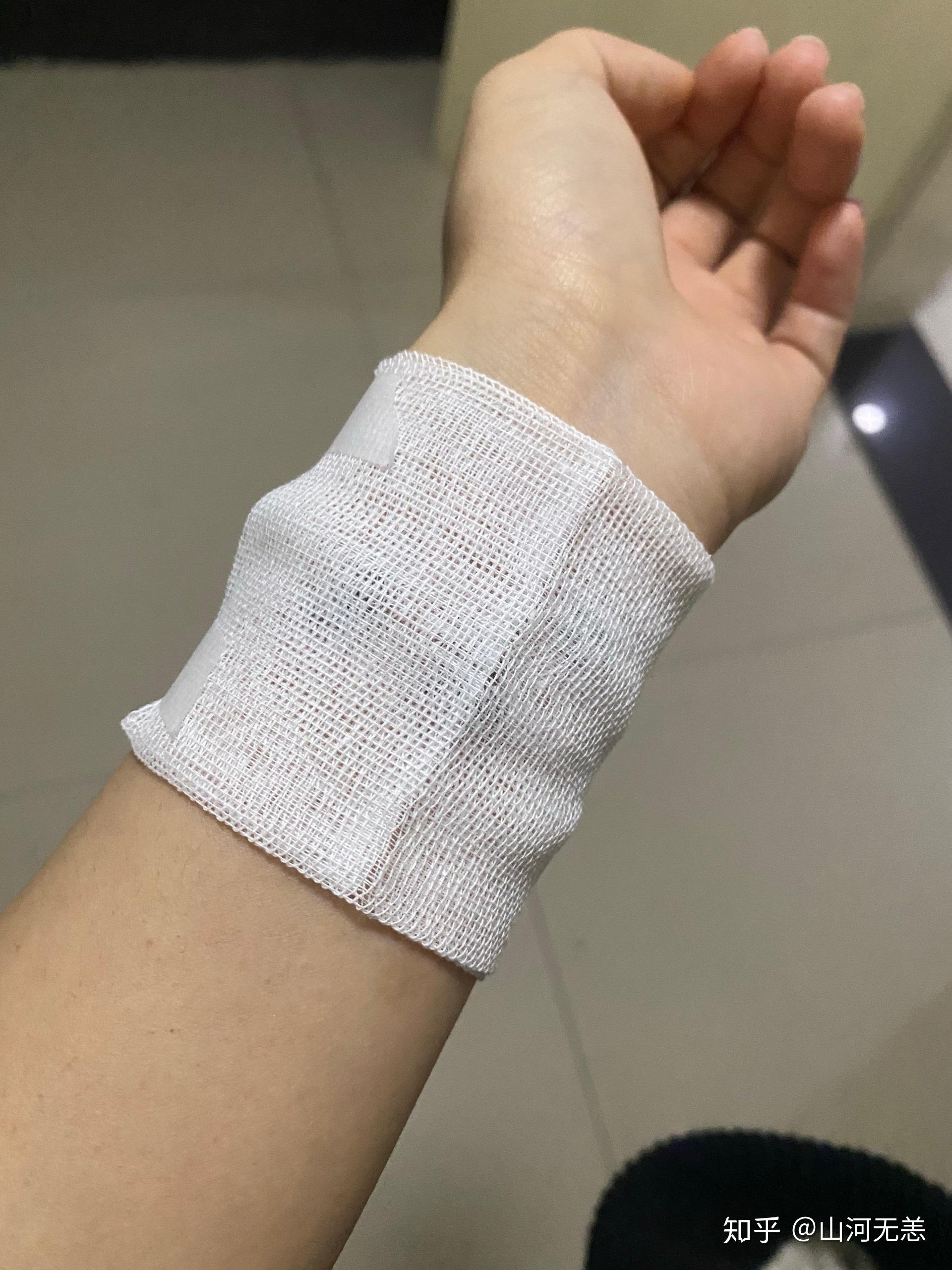 只是想记录下洗纹身的过程