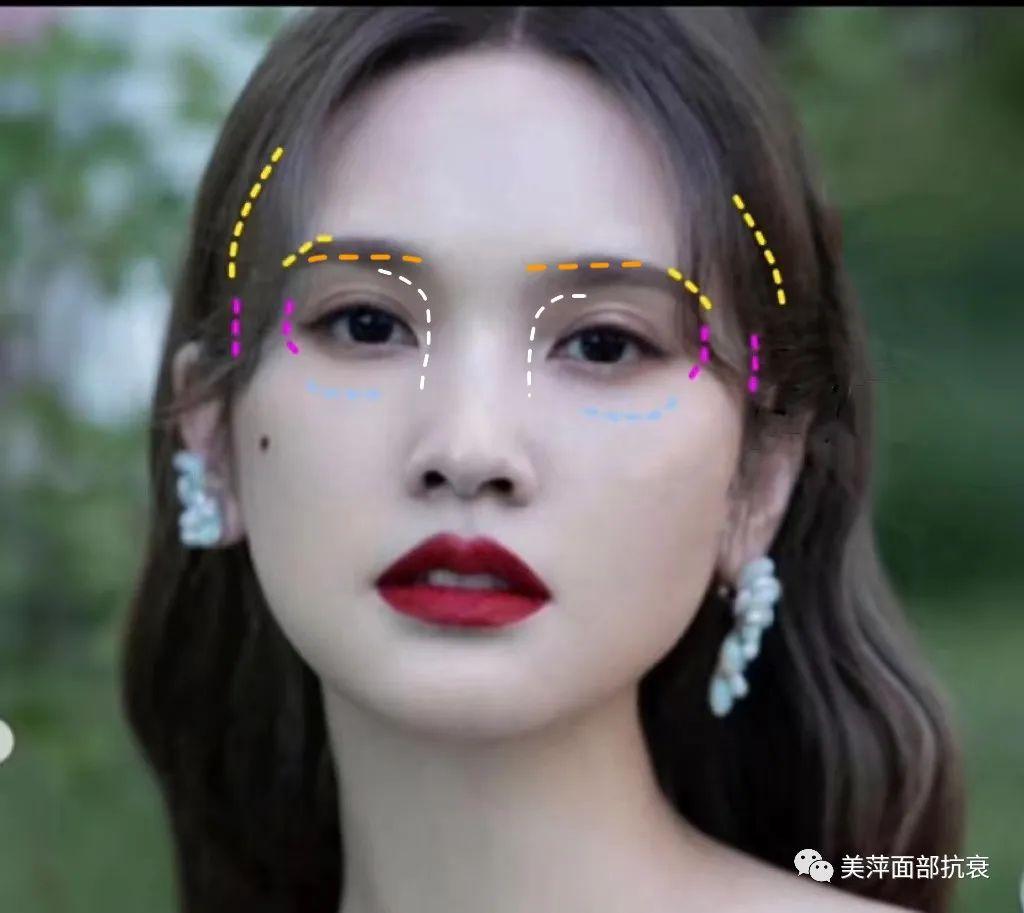 眼周衰老不要慌!学学女明星的⌈眼周固定⌋抗衰思路 - 知乎
