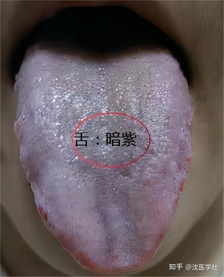 瘀血越重，汗越多，一个中成药，活血化瘀，专治自汗，盗汗 - 知乎