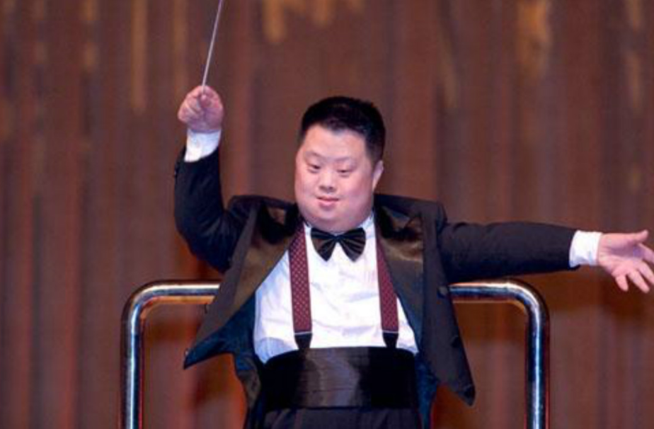 为什么唐氏综合征的孩子,没有遗传父母的相貌,长得都差不多? - 知乎