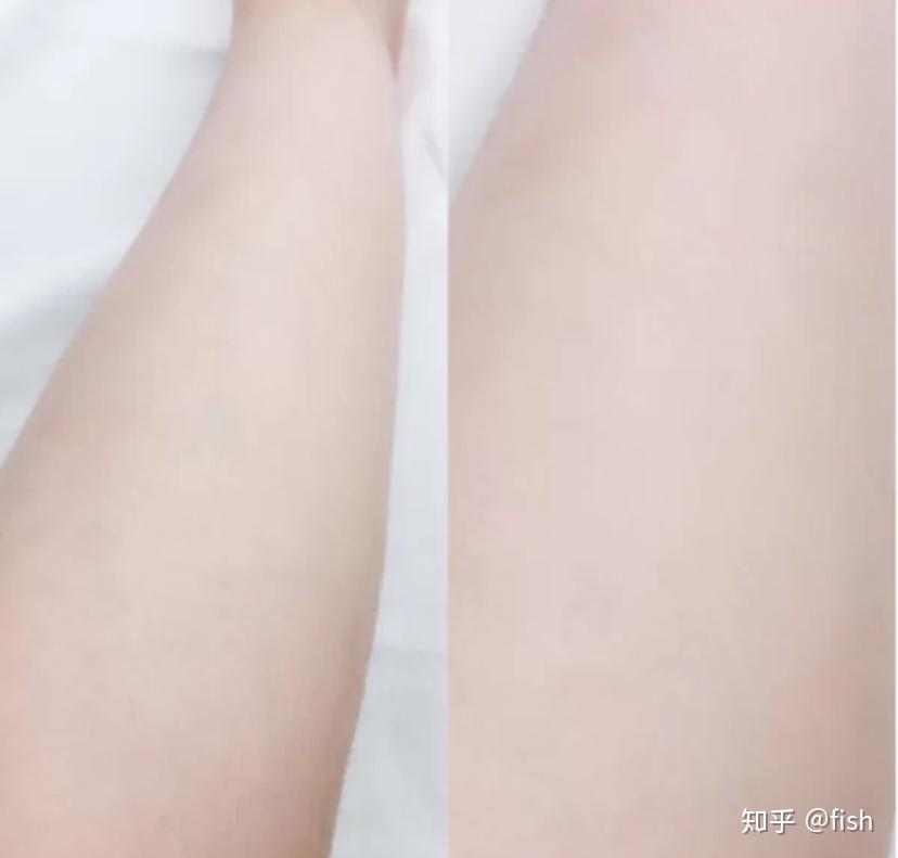 脱毛排名_脱毛对比图(2)