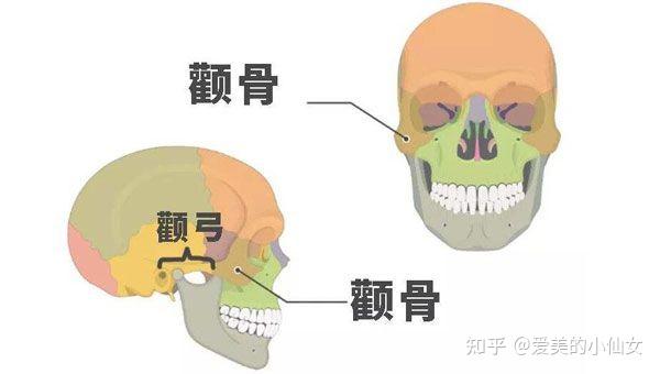 比如颧骨,颧弓外扩下颌角低导致的侧面方,下颌角宽,外翻导致的正面脸