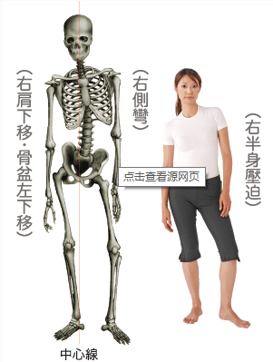 体态疼痛密切相连系列写作 骶髂关节紊乱 知乎 体态疼痛密切相连系列写作 骶髂关节紊乱 知乎