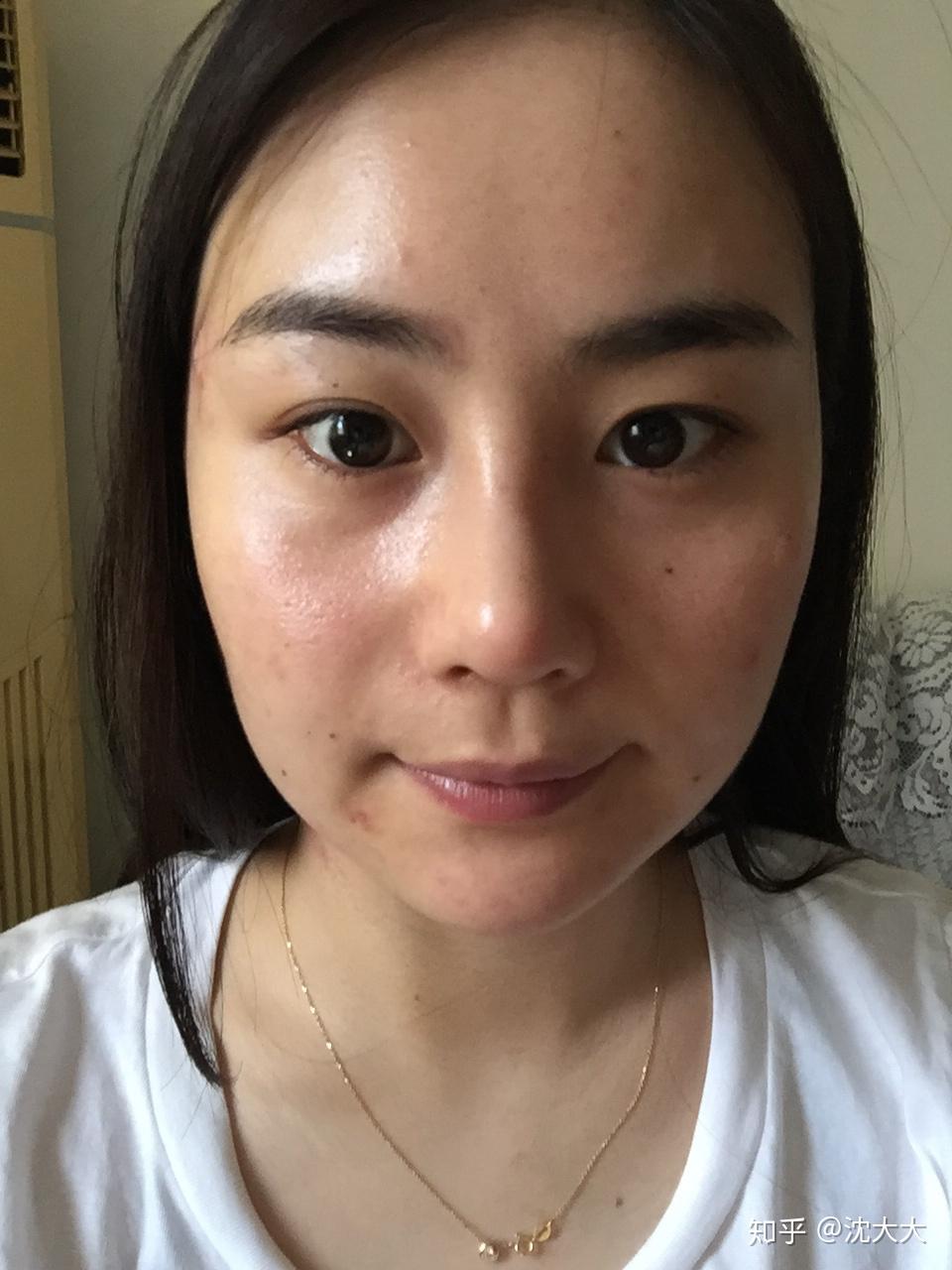 怎么拯救两边脸严重不对称?