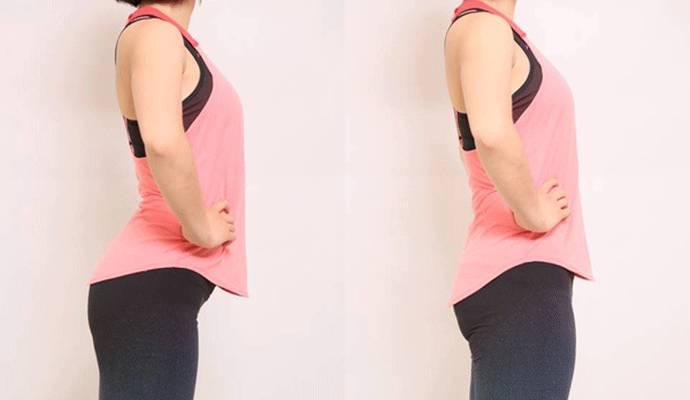 骨盆前倾的烦恼,远比你想的要多!