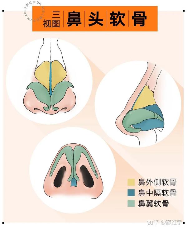 塌鼻子需要的鼻综合必备神器——“鼻头支架” - 知乎