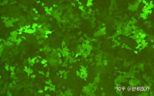 细胞基因过表达只会用慢病毒?2种新方法教你表达量UP UP UP !(一)转座子介导基因过表达 - 知乎
