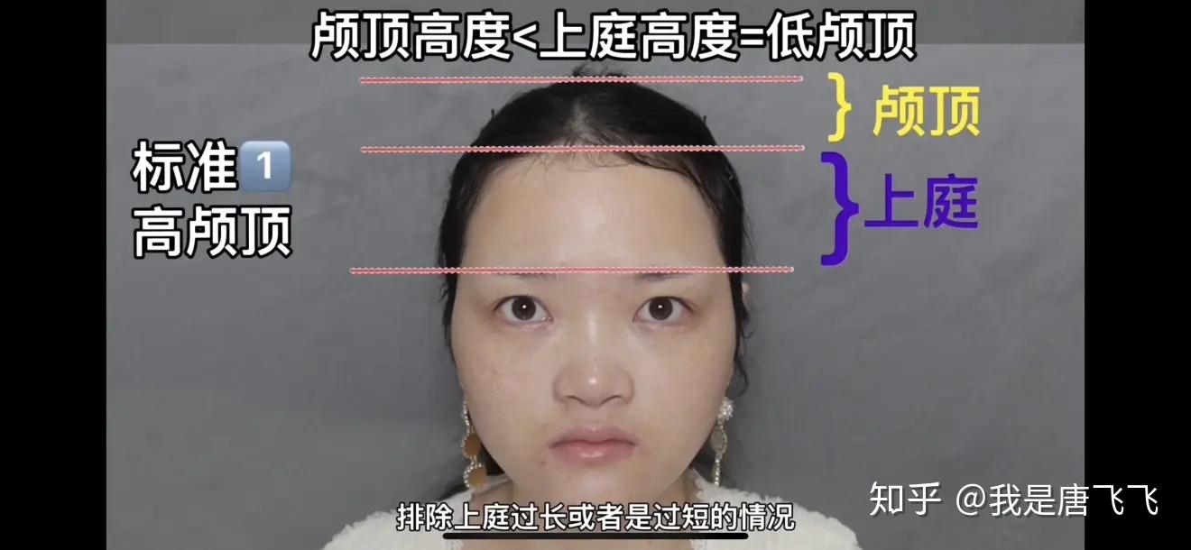 v2-db820bd15b1a57587dc0b6f5ddd5fcff_r.jpg