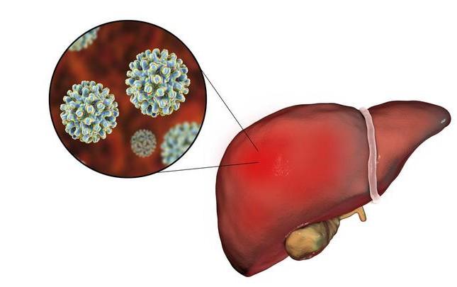 爱喝酒的人都要知道它能防治酒精性肝炎转给你关心的人看看吧