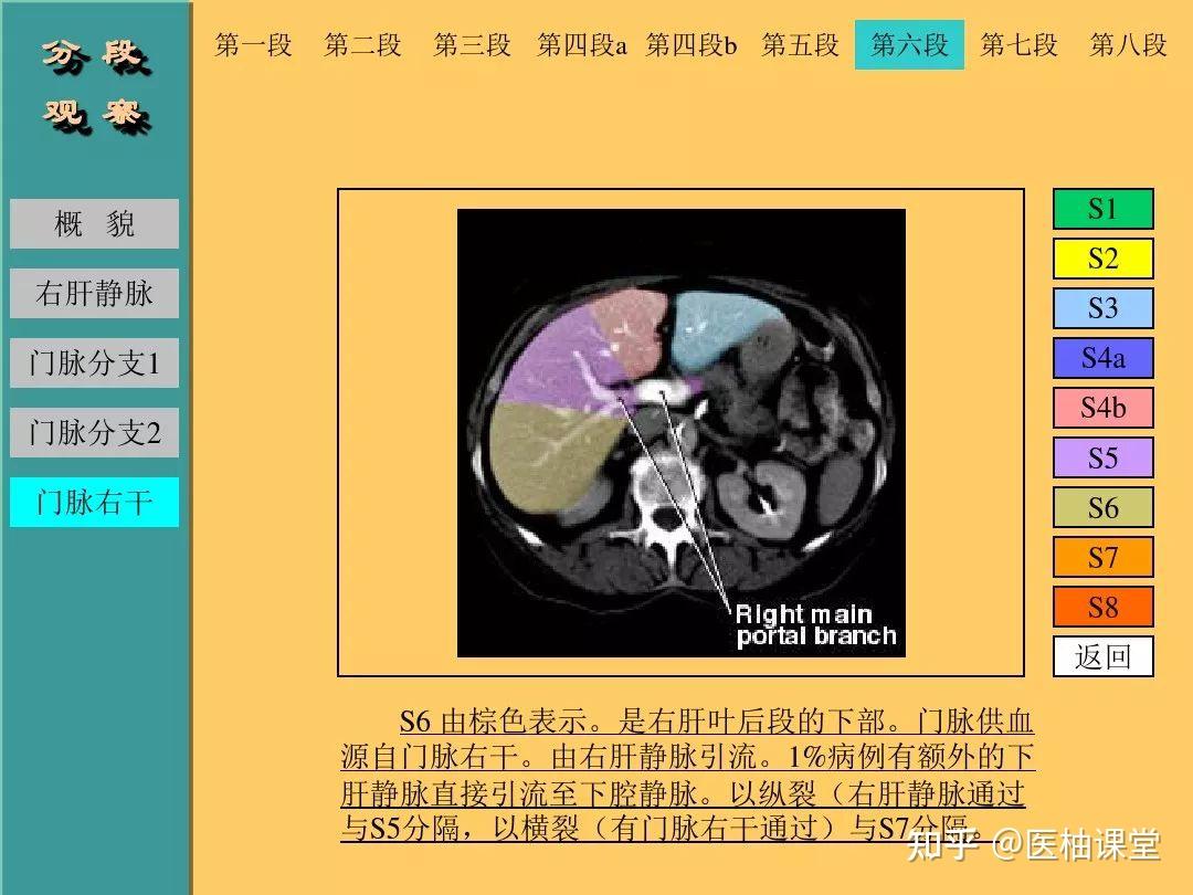 肝脏的CT断层解剖详解 - 知乎