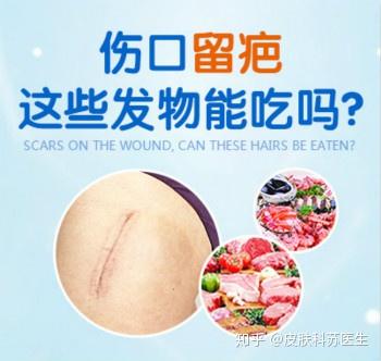 伤口留疤 这些发物不能吃 知乎