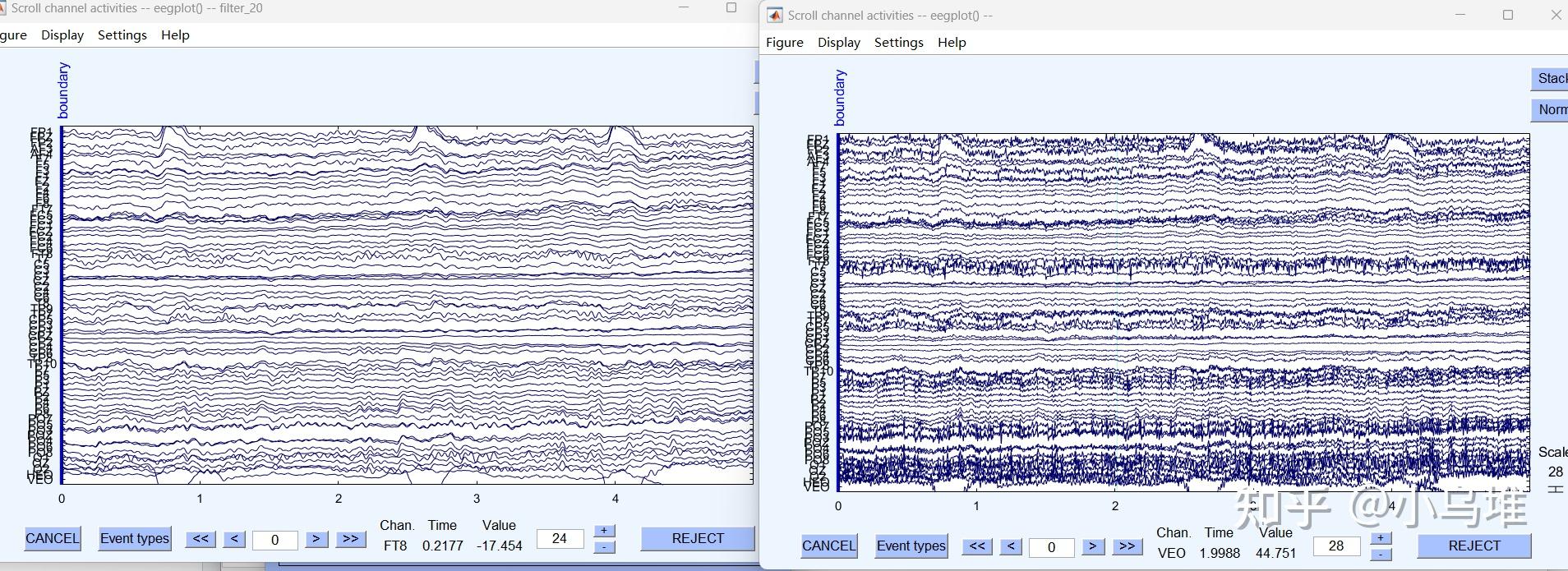 Matlab 2 eeglab 