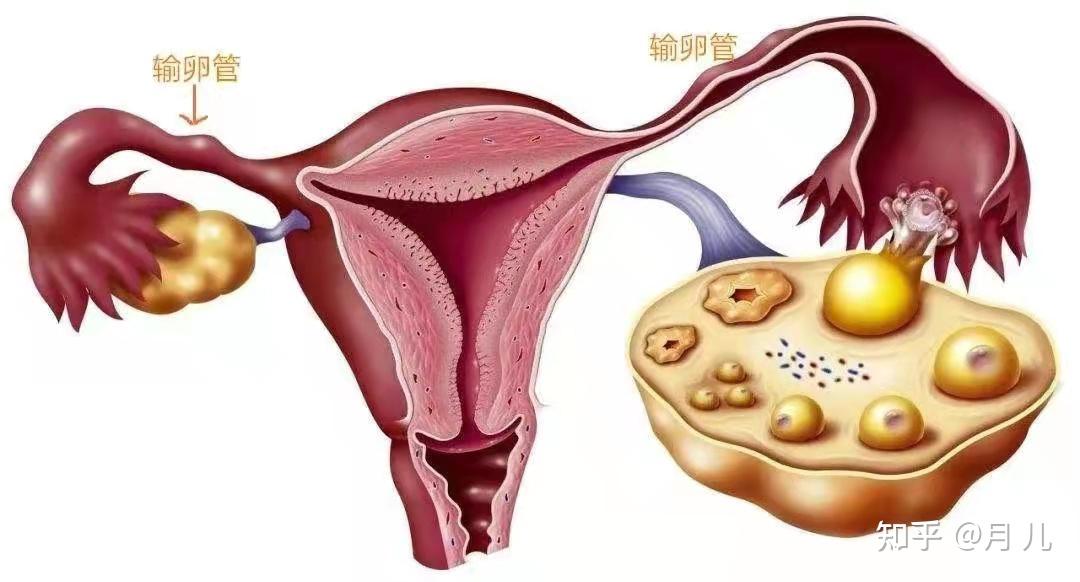 1,專家提醒輸卵管妊娠危害不小,所以當出現妊娠的症狀時,要定期去醫院