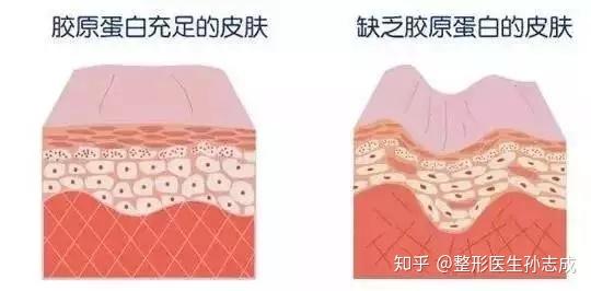 皮肤保护膜多久会干 v2-dcd4602bb4c96301c723bdd2abc8d7c3_r.jpg