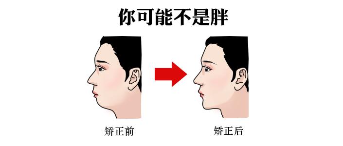 v2-dcf5e32ca6da908efb4c583d851348d4_1440w.jpg?source=172ae18b