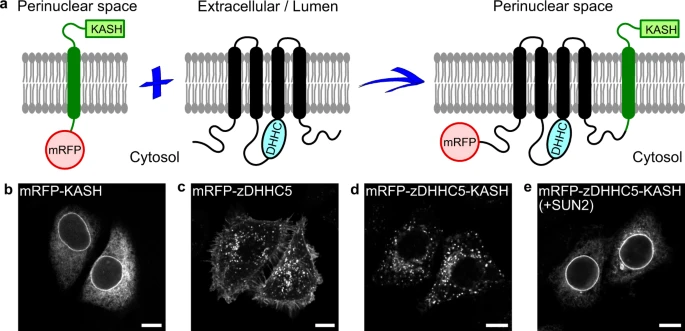 natcomm可视化棕榈酰化过程揭示癌症中相关蛋白定位变化
