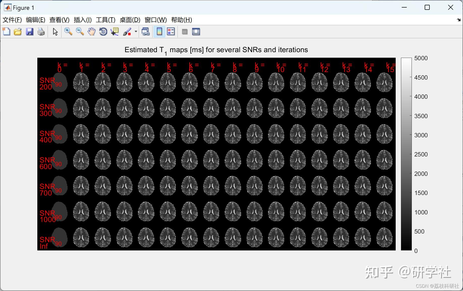 t1-nlls-spgr-t1-matlab