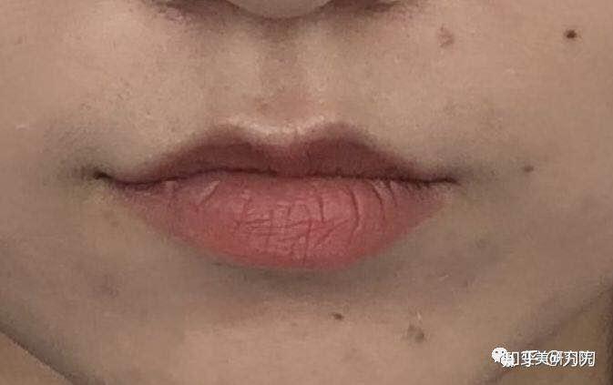 唇型为极具特色的猫弧唇配上直面型,上唇上翘且唇峰明显,线条尖细,稍