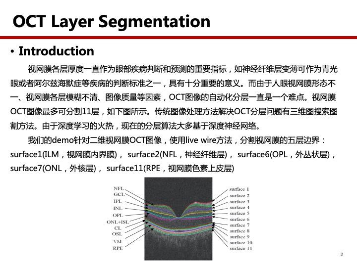 oct视网膜分层demo