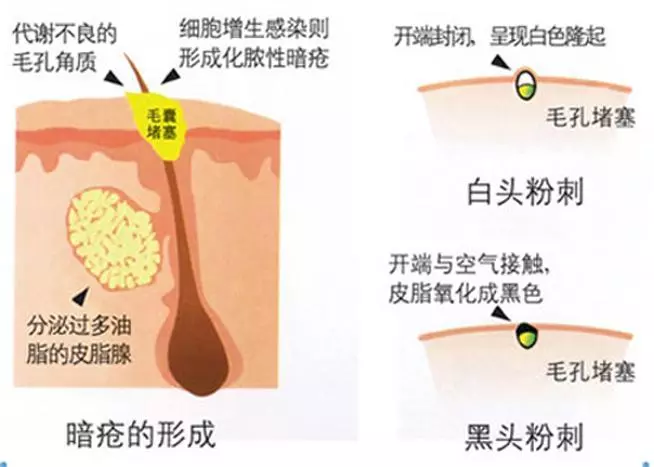 v2-dd6b8135ff5e45ef0db79d1281986153_r.jpg