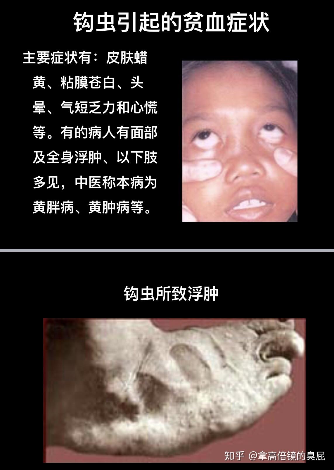 v2-ddace623b395e8b80b895e530cba08bf_r.jpg