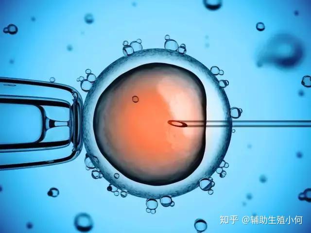 v2-ddbfdf880a473001f2e0f20066faac9f_r.jpg