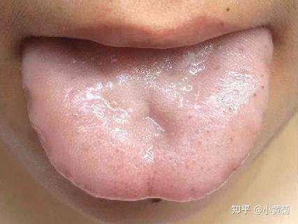 血虚证典型舌象特征 - 知乎