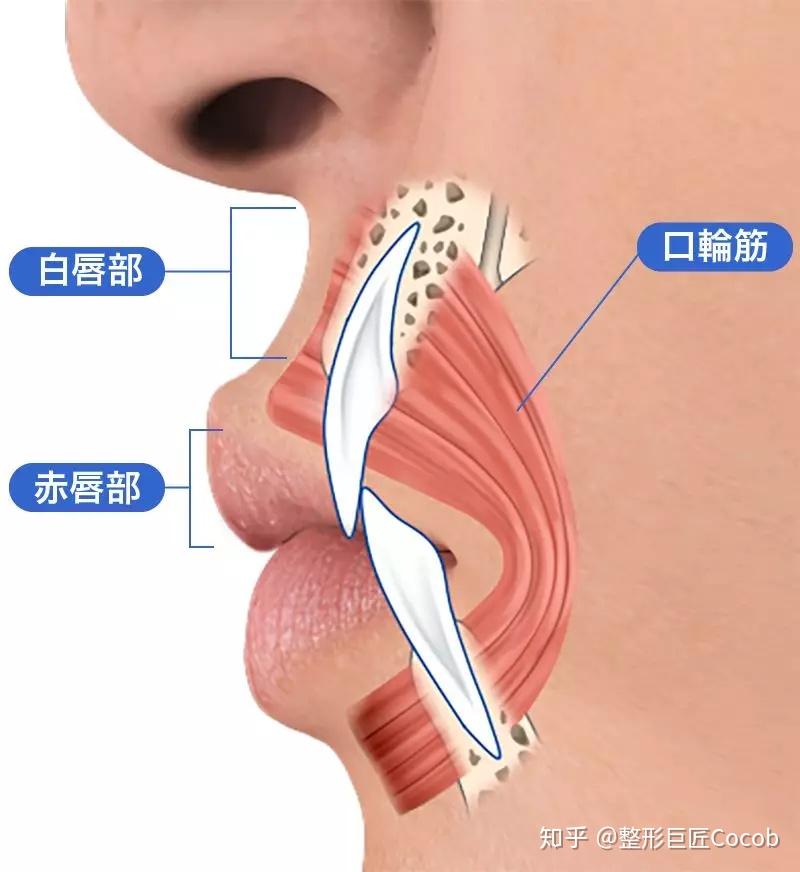常见的切除缩短方法↓将切口隐藏在鼻翼下方,去除部分皮肤 悬吊口轮匝