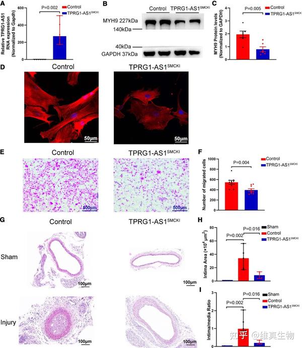 中国医学科学院阜外医院王来元/顾东风研究团队揭示LncRNA TPRG1-AS1在抑制动脉粥样硬化中的关键作用! - 知乎