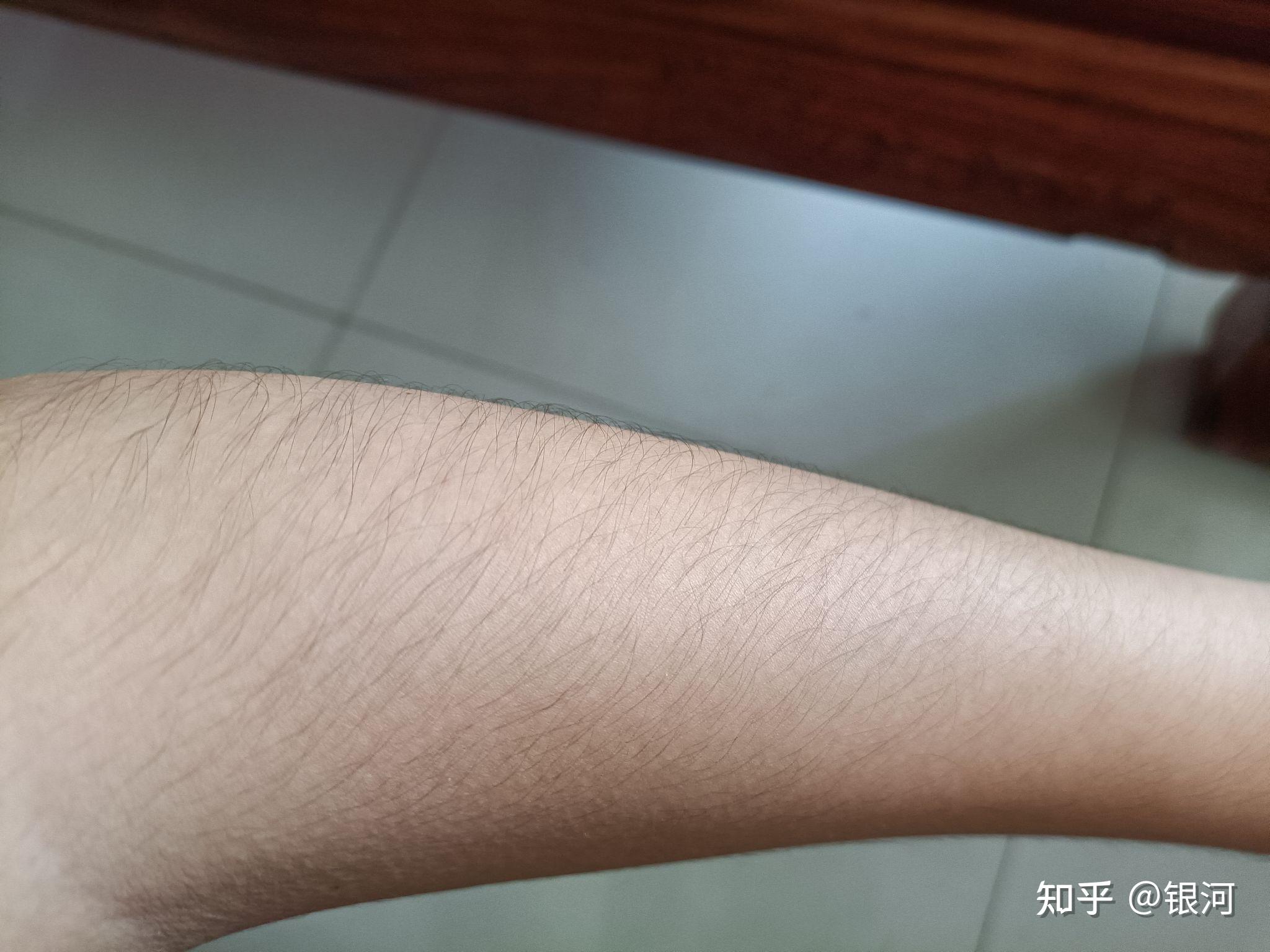 刚买了一个ulike脱毛仪准备在这里说一下效果做个脱毛日记08