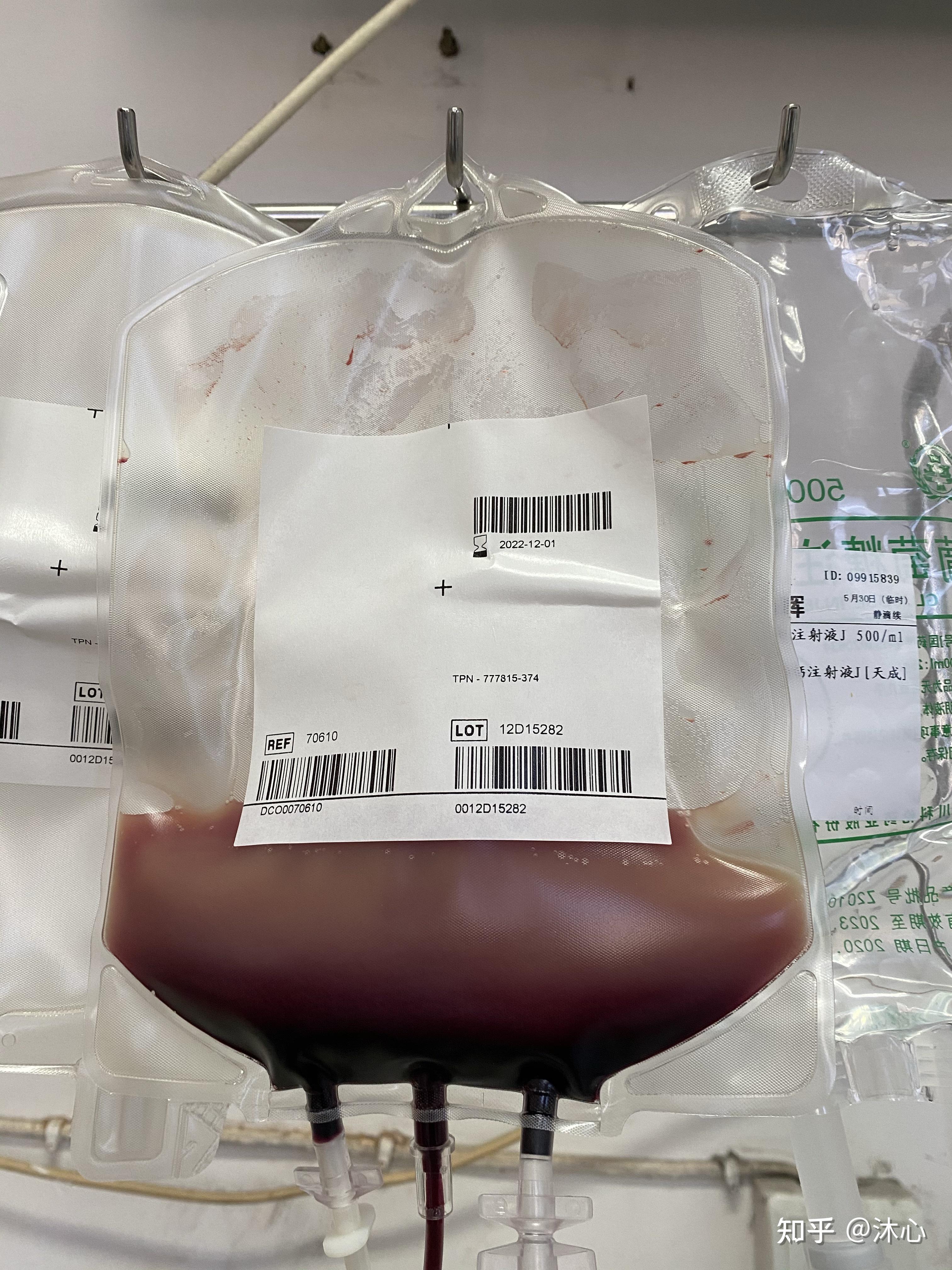 急性髓系白血病(m5高危)重生路上