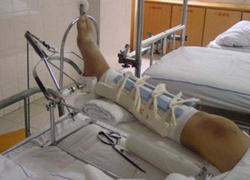 洗浴中心摔倒不在少数你想过你可以要求赔偿吗