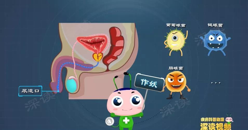 穿错内裤会蛋疼?睾丸炎是因私生活乱?睾丸炎预防招数大放送! - 知乎