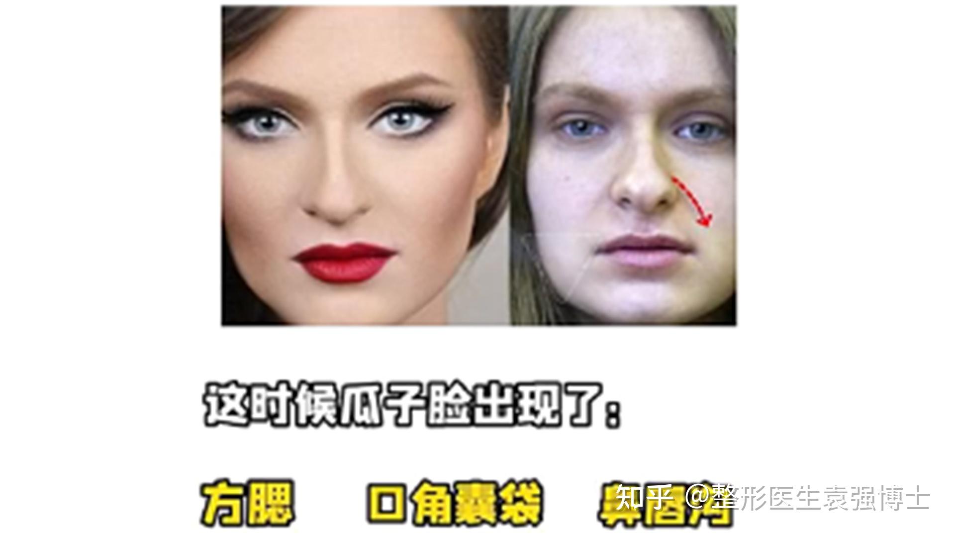 医生支招:脸部两腮下垂怎么办? - 知乎
