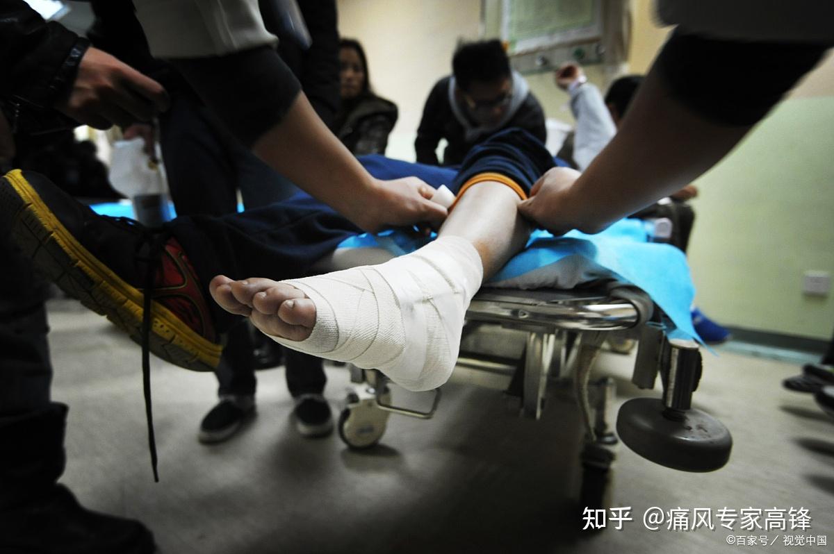 痛风和崴脚、扭伤有什么区别?可以从这几个方面看 - 知乎