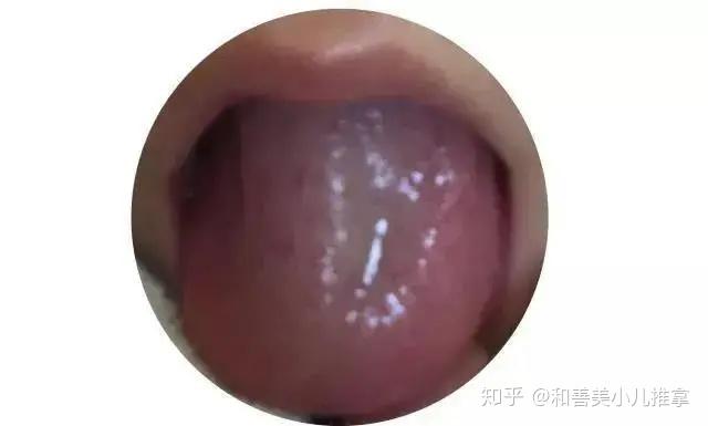 v2-deba7807f9a1a72fb1ac5566d762a5ef_r.jpg