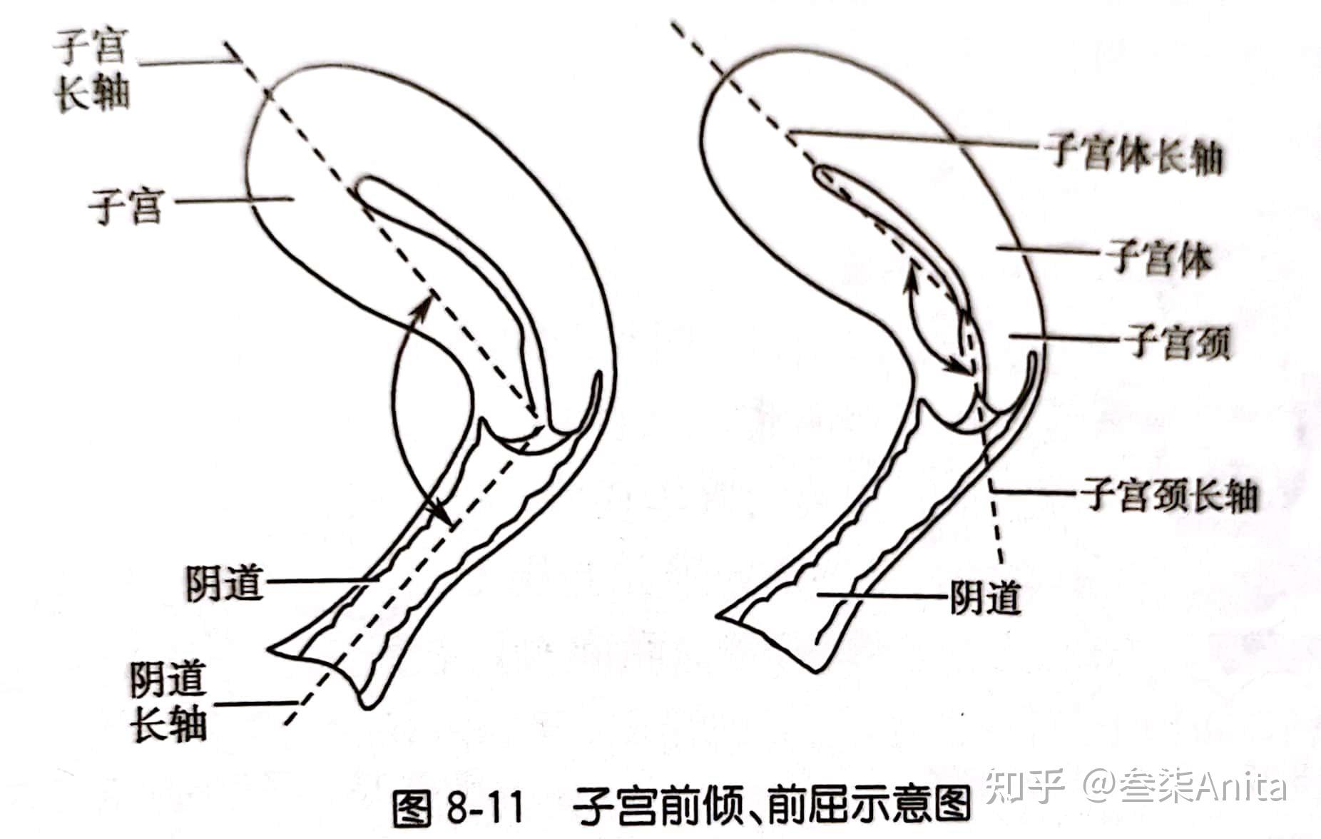 子宫侧面图图片