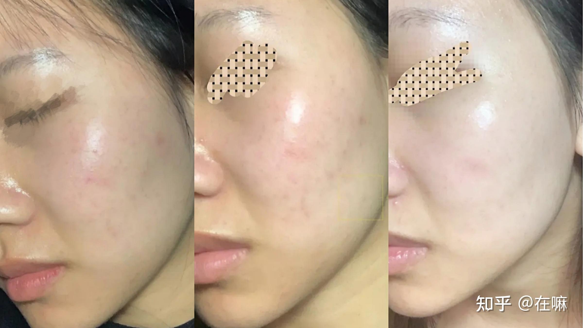 怎么把自己皮肤养得好好的