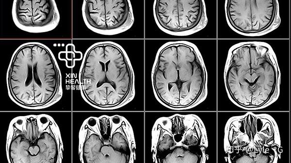 X B Ct Mri