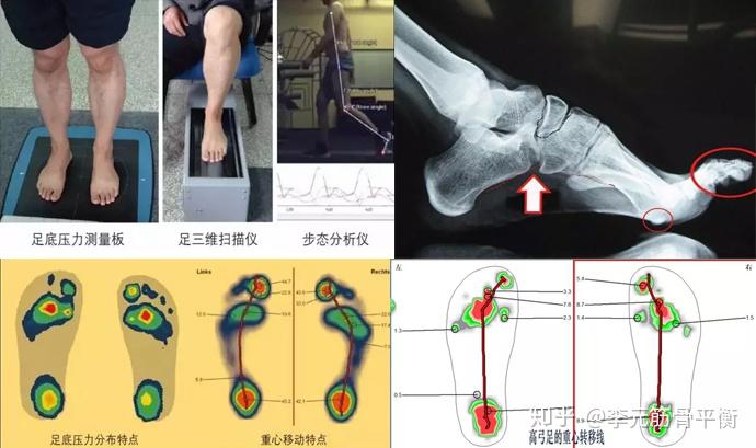 升级你的足球享受：最佳应用，提供高清直播，精彩重播和集锦