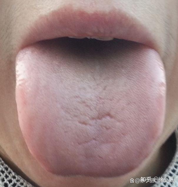阳虚体质秋冬季节该如何保养? - 知乎