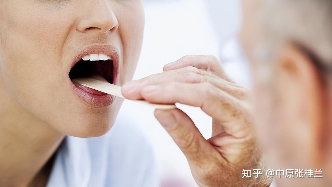 慢性咽炎的症状及表现有哪些 你知道吗 - 知乎