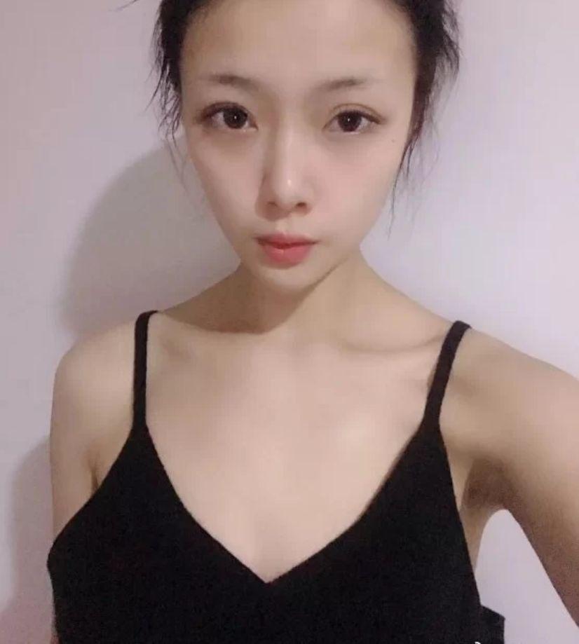 广州做隆胸有哪些专家假体胸和自体脂肪隆胸都可以介绍一下吗还有大概