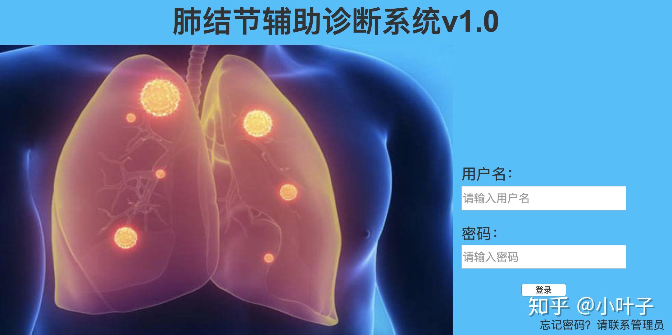 肺積水 - Healthceo 健康自理