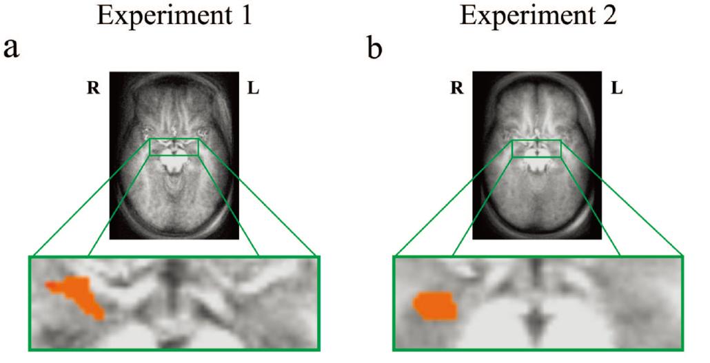 杏仁核在情绪处理过程中的功能