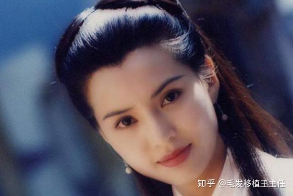 种植美人尖对脸型有要求吗 什么人适合种植美人尖 知乎