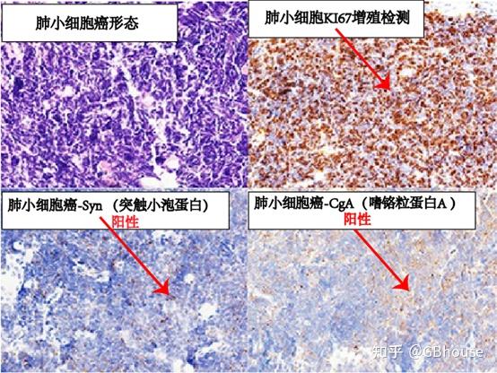 组织形态学免/疫组化免疫/荧光四部曲之----免疫组化（IHC） - 知乎