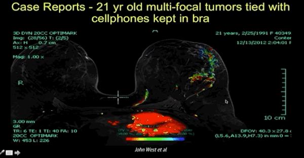 手机辐射的潜在危害 到底谁在造谣 知乎