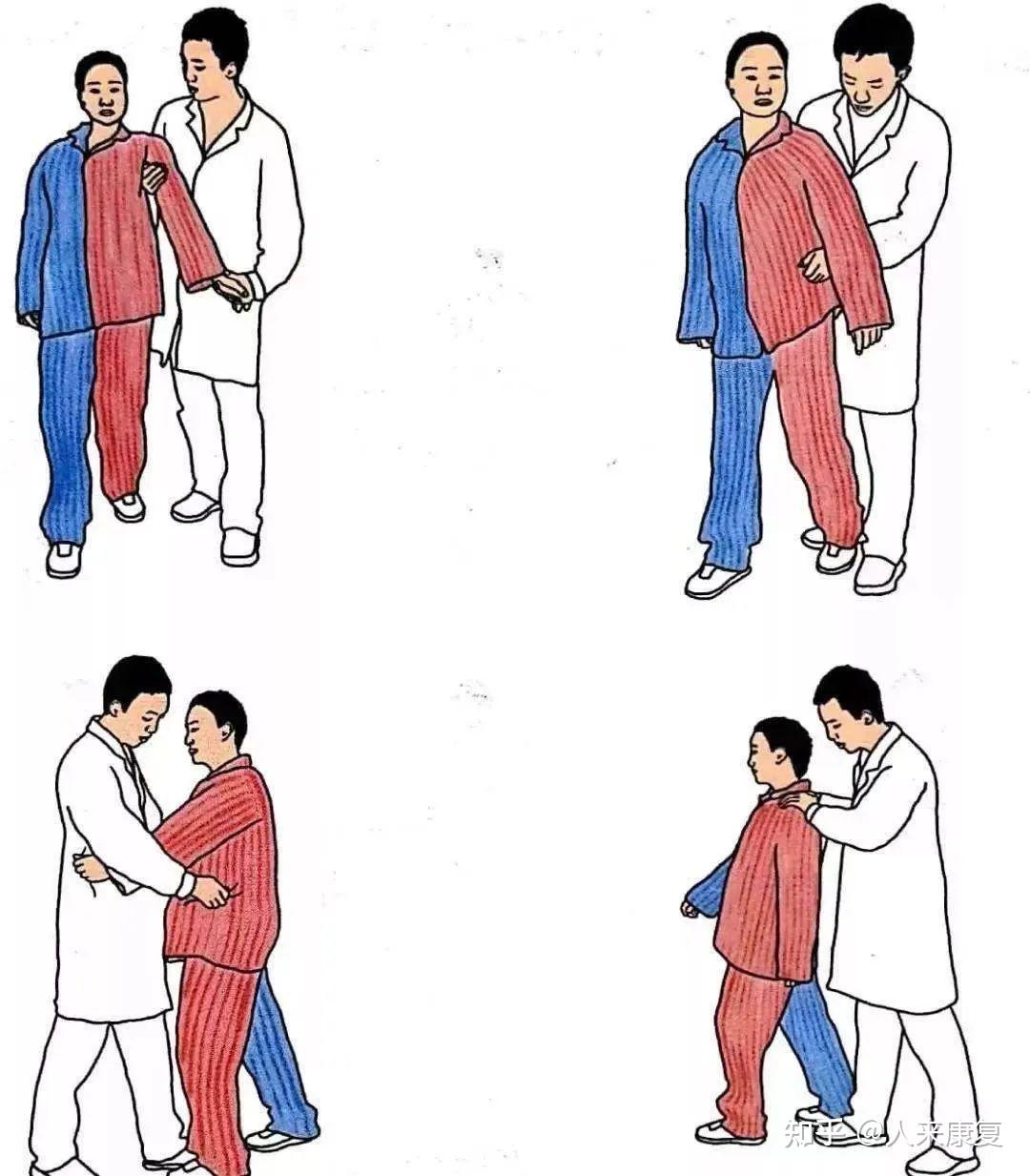 脑卒中患者步行训练【人来康复】 - 知乎