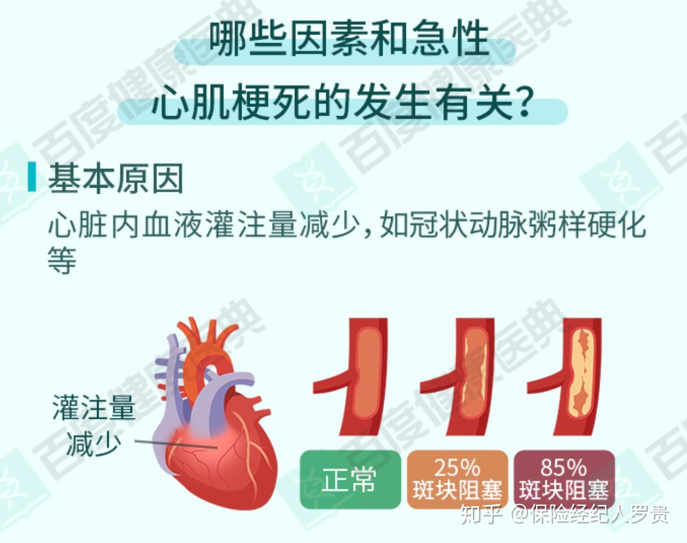 第一,什么是急性心肌梗塞?第三,主要症状以及重疾险是如何理赔
